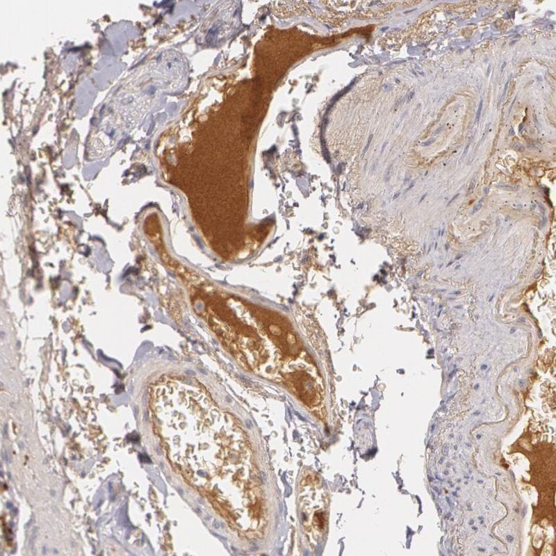 LBP Antibody - BSA Free Immunohistochemistry: LBP Antibody - BSA Free [NBP1-88371]