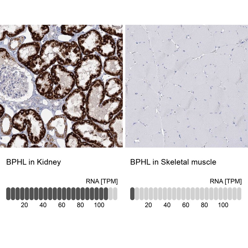 BPHL Antibody - BSA Free Immunohistochemistry-Paraffin: BPHL Antibody [NBP1-88373]