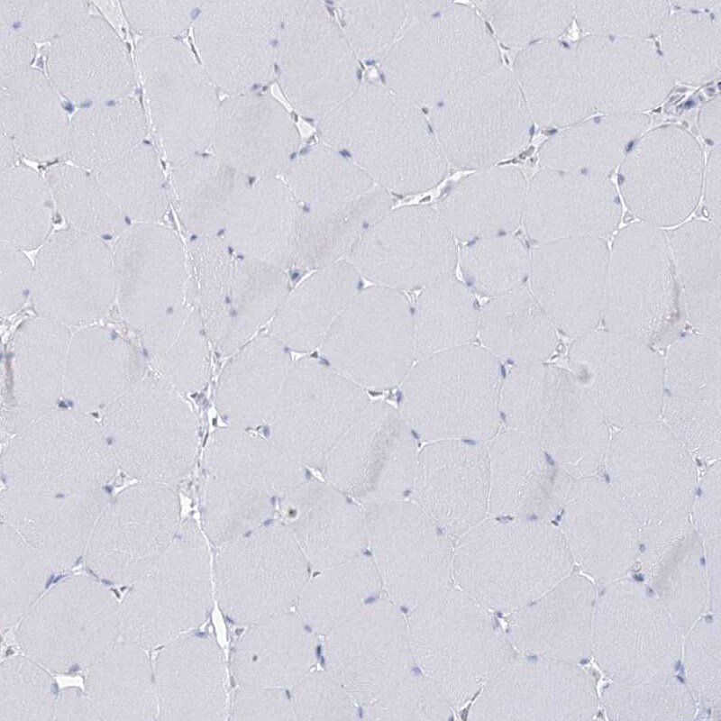 BPHL Antibody - BSA Free Immunohistochemistry-Paraffin: BPHL Antibody [NBP1-88373]