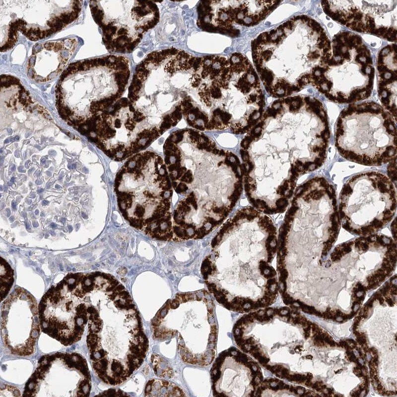 BPHL Antibody - BSA Free Immunohistochemistry-Paraffin: BPHL Antibody [NBP1-88373]