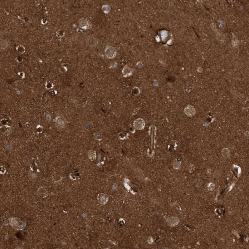 CDC42EP4 Antibody - BSA Free Immunohistochemistry-Paraffin: CDC42EP4 Antibody - BSA Free [NBP1-88380]