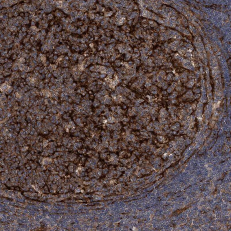 CDC42EP4 Antibody - BSA Free Immunohistochemistry-Paraffin: CDC42EP4 Antibody - BSA Free [NBP1-88380]