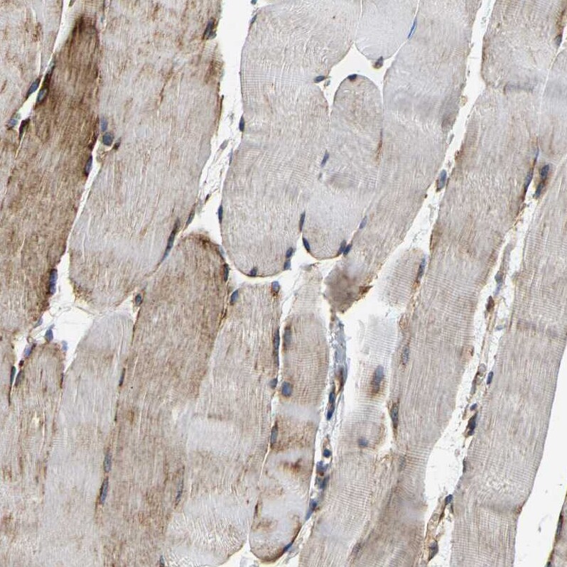 DUSP8 Antibody - BSA Free Immunohistochemistry-Paraffin: DUSP8 Antibody - BSA Free [NBP1-88385]