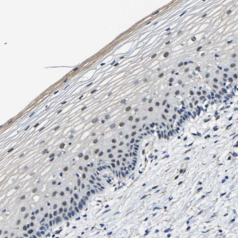 METTL1 Antibody - BSA Free Immunohistochemistry-Paraffin: METTL1 Antibody - BSA Free [NBP1-88386]