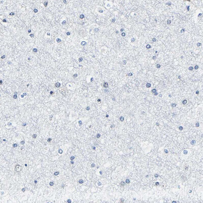 METTL1 Antibody - BSA Free Immunohistochemistry-Paraffin: METTL1 Antibody - BSA Free [NBP1-88386]