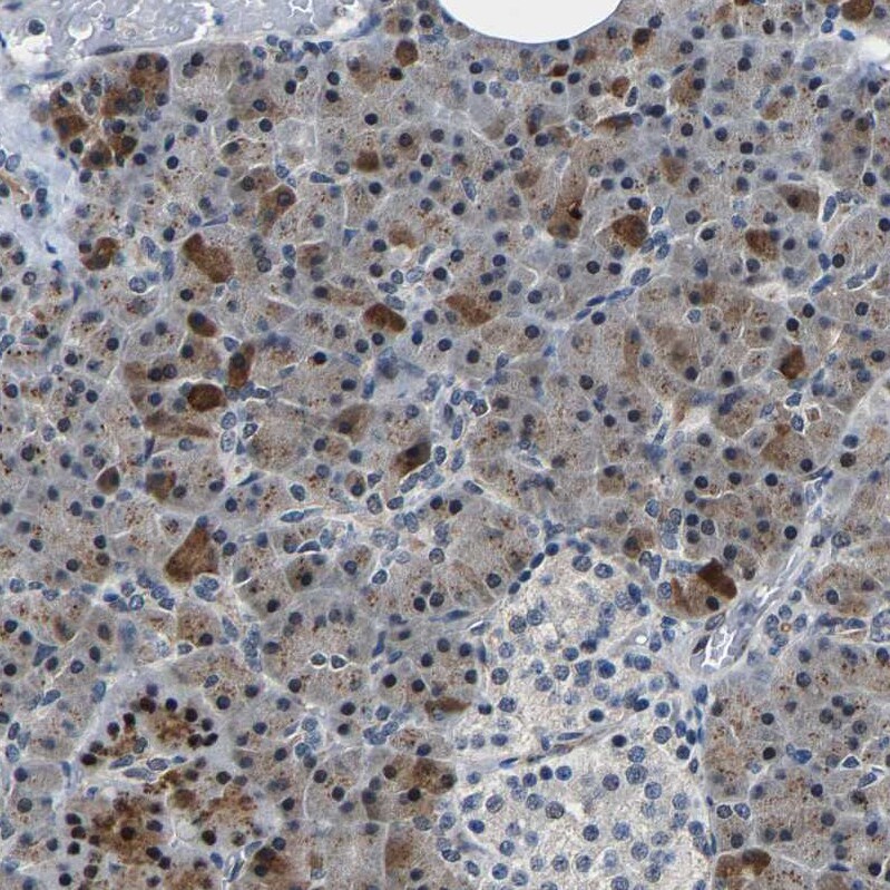 METTL1 Antibody - BSA Free Immunohistochemistry-Paraffin: METTL1 Antibody - BSA Free [NBP1-88386]