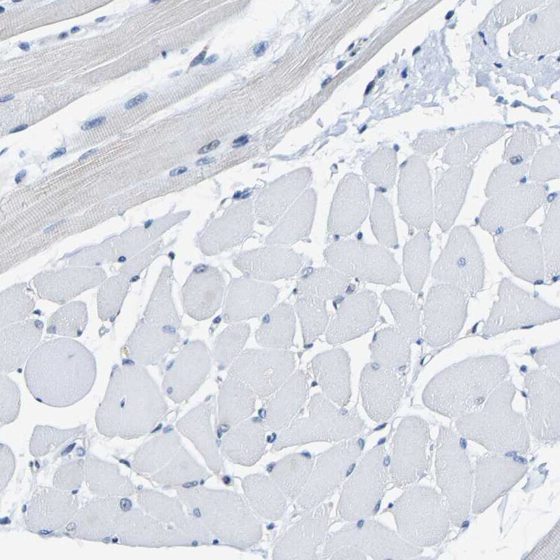 METTL1 Antibody - BSA Free Immunohistochemistry-Paraffin: METTL1 Antibody - BSA Free [NBP1-88386]