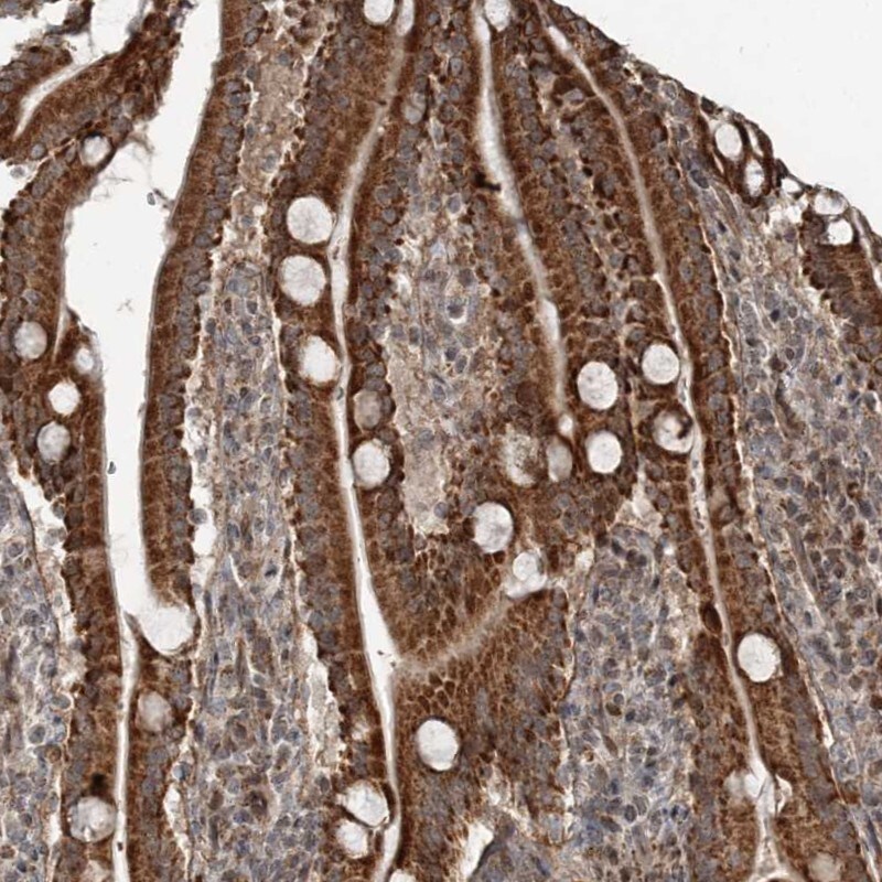 RASSF8 Antibody - BSA Free Immunohistochemistry-Paraffin: RASSF8 Antibody [NBP1-88388]
