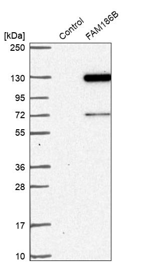 FAM186B Antibody - BSA Free Western Blot: FAM186B Antibody - BSA Free [NBP1-88389]