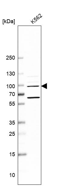 NAA25 Antibody - BSA Free Western Blot: NAA25 Antibody - BSA Free [NBP1-88391]