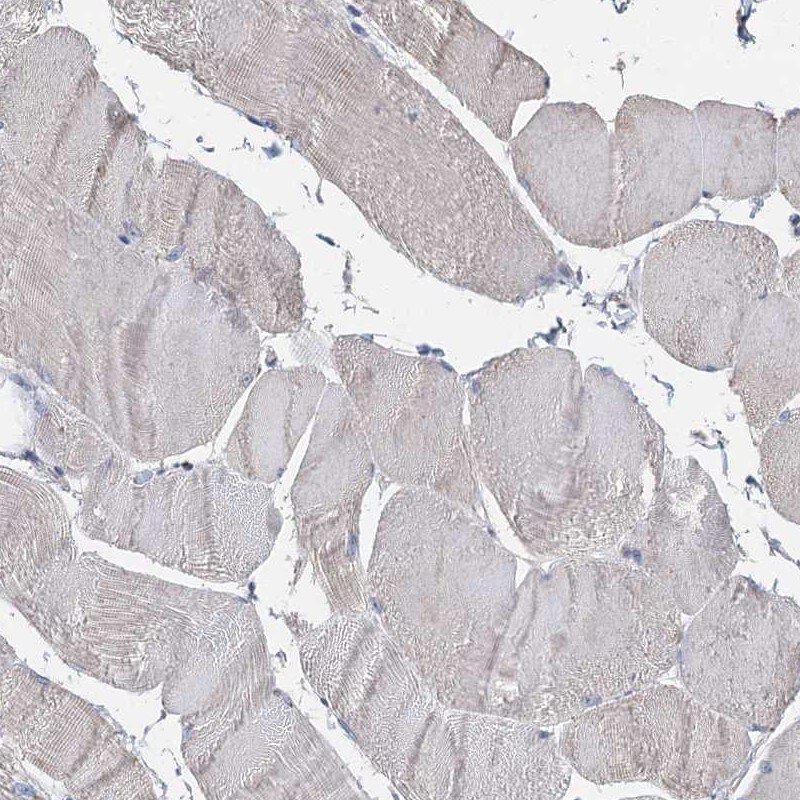 TCTN2 Antibody - BSA Free Immunohistochemistry-Paraffin: TCTN2 Antibody [NBP1-88392]