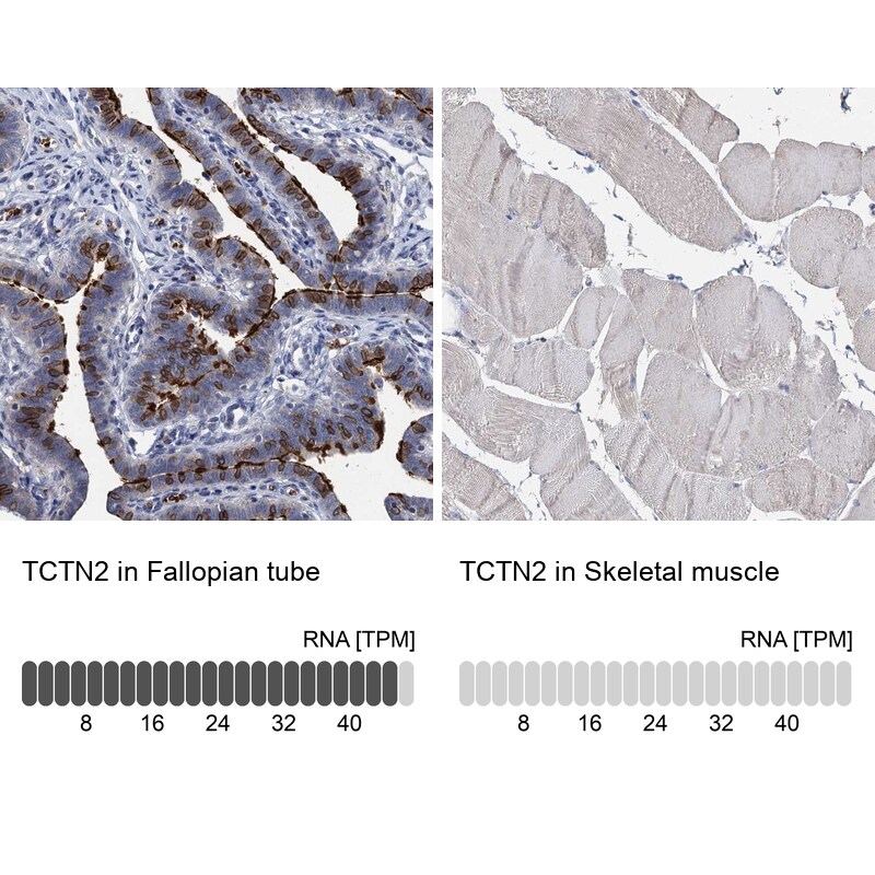 TCTN2 Antibody - BSA Free Immunohistochemistry-Paraffin: TCTN2 Antibody [NBP1-88392]