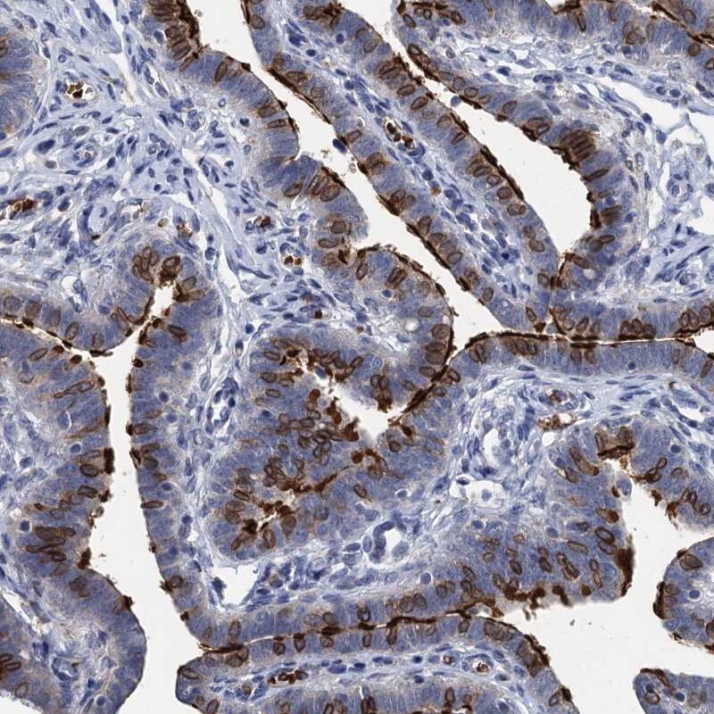 TCTN2 Antibody - BSA Free Immunohistochemistry-Paraffin: TCTN2 Antibody [NBP1-88392]