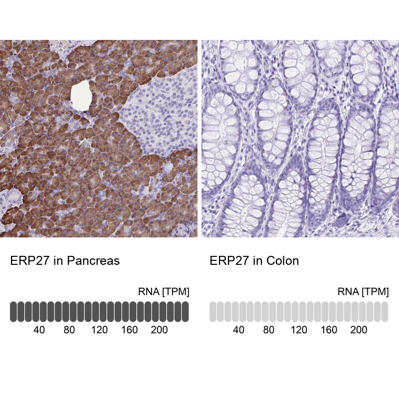 ERP27 Antibody - BSA Free Immunohistochemistry-Paraffin: ERP27 Antibody [NBP1-88393]