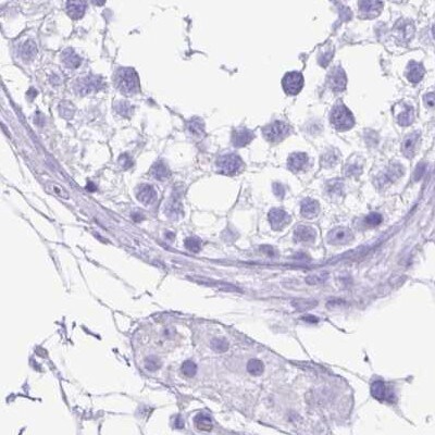 ERP27 Antibody - BSA Free Immunohistochemistry-Paraffin: ERP27 Antibody [NBP1-88393]