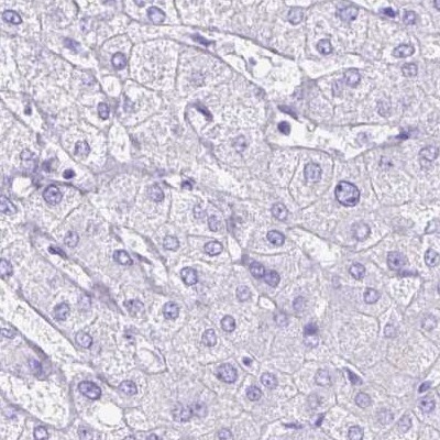 ERP27 Antibody - BSA Free Immunohistochemistry-Paraffin: ERP27 Antibody [NBP1-88393]