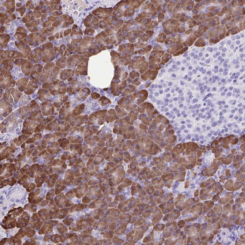 ERP27 Antibody - BSA Free Immunohistochemistry-Paraffin: ERP27 Antibody [NBP1-88393]