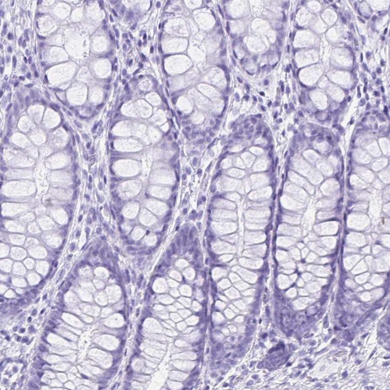 ERP27 Antibody - BSA Free Immunohistochemistry-Paraffin: ERP27 Antibody [NBP1-88393]