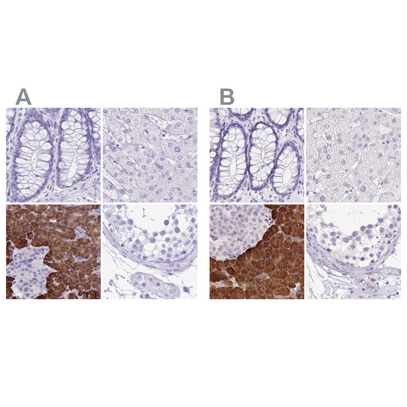 ERP27 Antibody - BSA Free Immunohistochemistry-Paraffin: ERP27 Antibody [NBP1-88393]