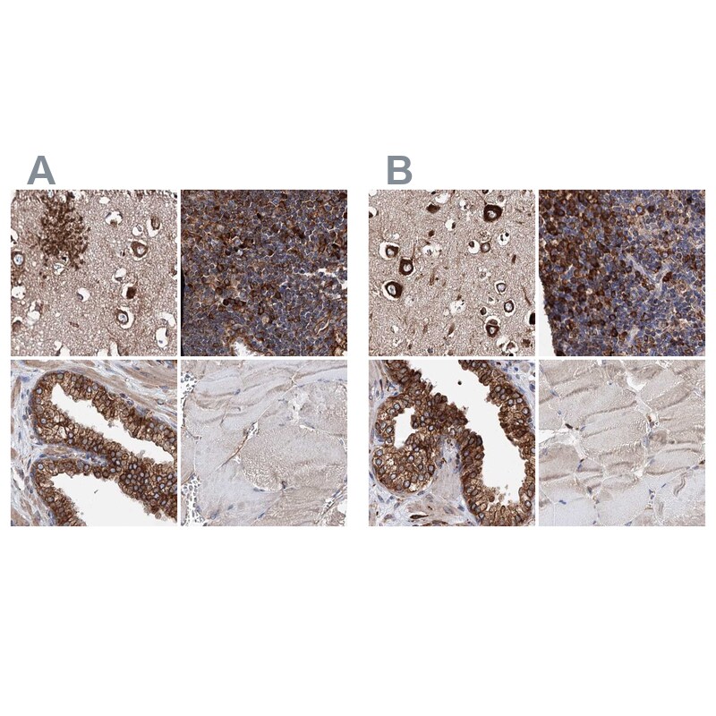 ERP29 Antibody - BSA Free Immunohistochemistry-Paraffin: ERP29 Antibody [NBP1-88395]
