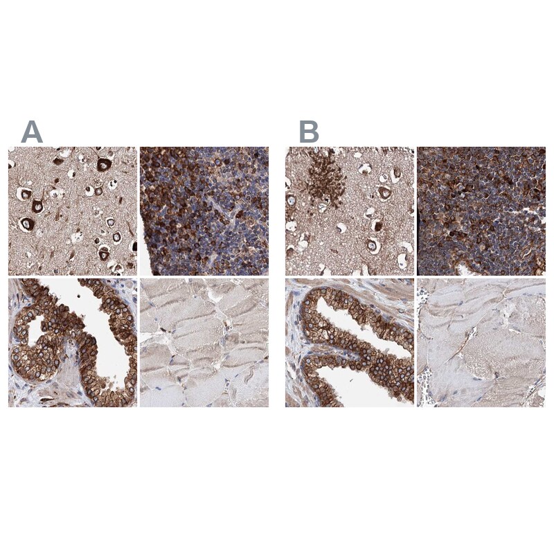 ERP29 Antibody - BSA Free Immunohistochemistry-Paraffin: ERP29 Antibody [NBP1-88396]