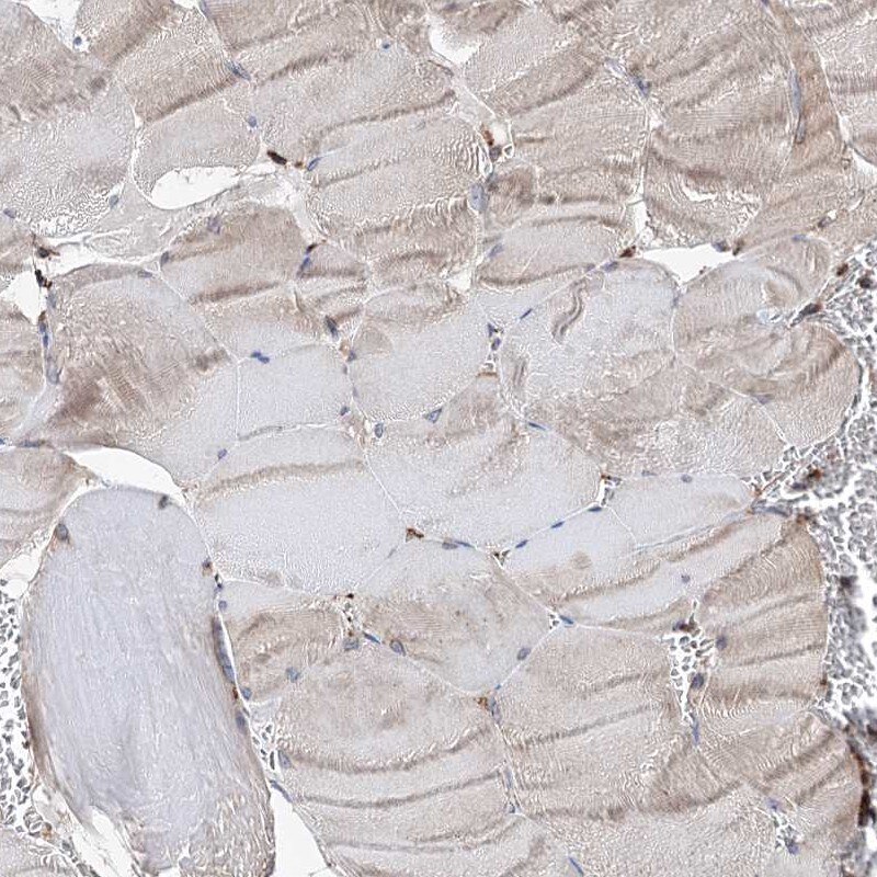 ERP29 Antibody - BSA Free Immunohistochemistry-Paraffin: ERP29 Antibody - BSA Free [NBP1-88396]