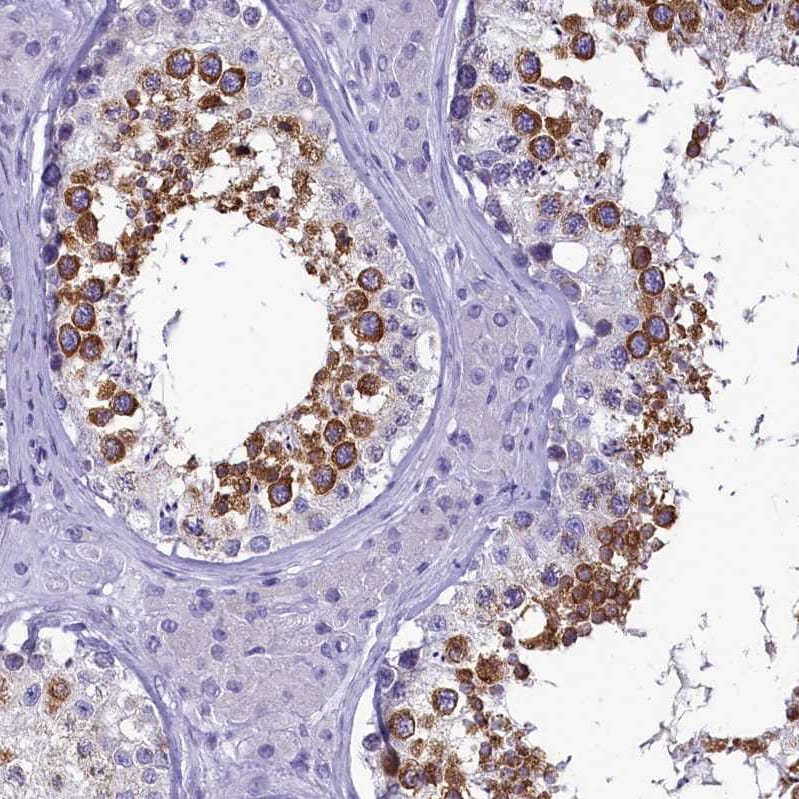 SKA3 Antibody - BSA Free Immunohistochemistry-Paraffin: SKA3 Antibody - BSA Free [NBP1-88398]
