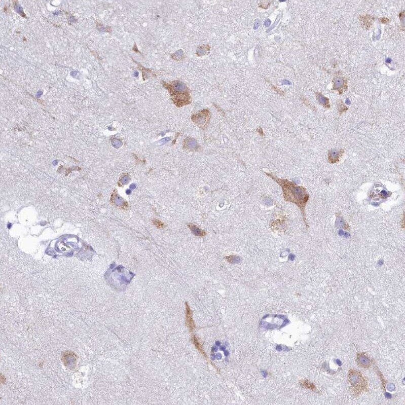 SKA3 Antibody - BSA Free Immunohistochemistry-Paraffin: SKA3 Antibody - BSA Free [NBP1-88398]