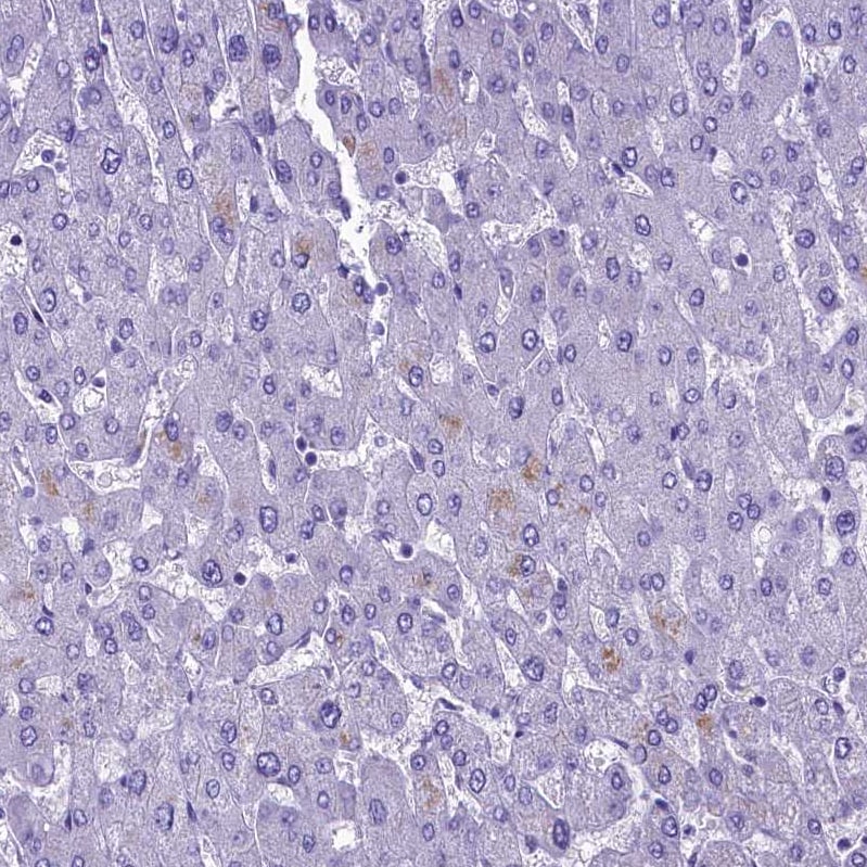 SKA3 Antibody - BSA Free Immunohistochemistry-Paraffin: SKA3 Antibody - BSA Free [NBP1-88398]