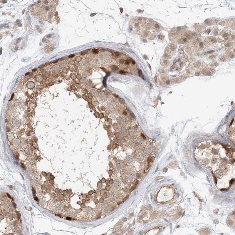 RNF219 Antibody - BSA Free Immunohistochemistry-Paraffin: RNF219 Antibody [NBP1-88401]