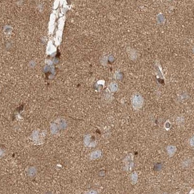 RNF219 Antibody - BSA Free Immunohistochemistry-Paraffin: RNF219 Antibody [NBP1-88401]