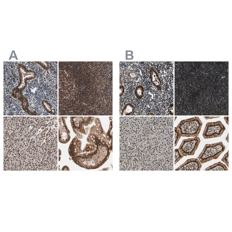 ZNF828 Antibody - BSA Free Immunohistochemistry-Paraffin: ZNF828 Antibody - BSA Free [NBP1-88402]