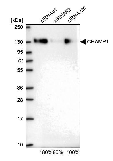 ZNF828 Antibody - BSA Free Western Blot: ZNF828 Antibody - BSA Free [NBP1-88402]