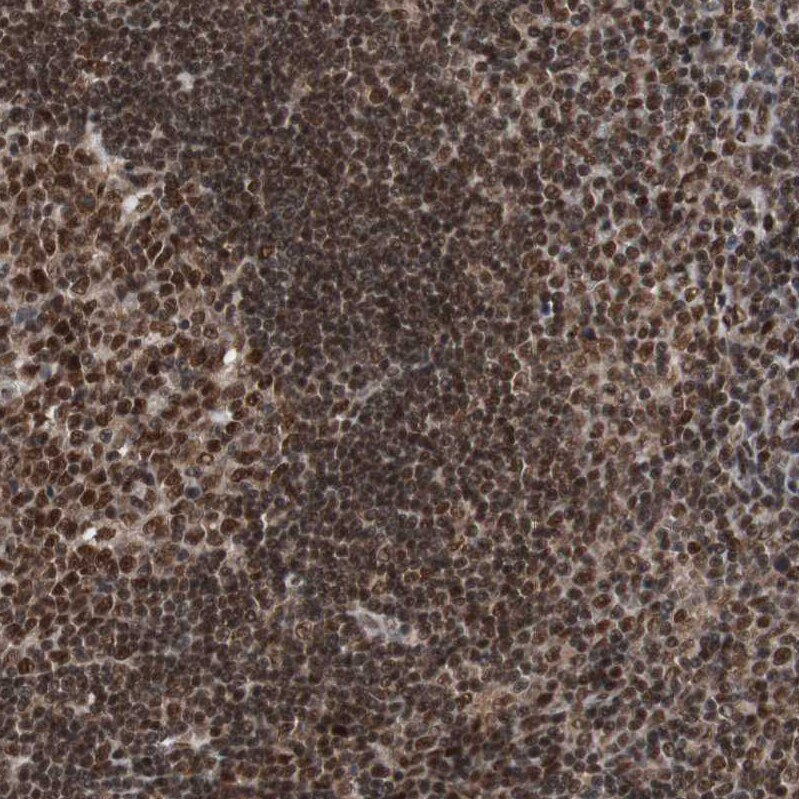 ZNF828 Antibody - BSA Free Immunohistochemistry-Paraffin: ZNF828 Antibody - BSA Free [NBP1-88402]