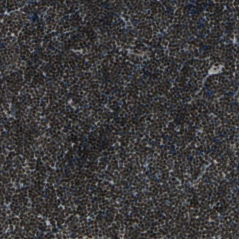 ZNF828 Antibody - BSA Free Immunohistochemistry-Paraffin: ZNF828 Antibody - BSA Free [NBP1-88403]
