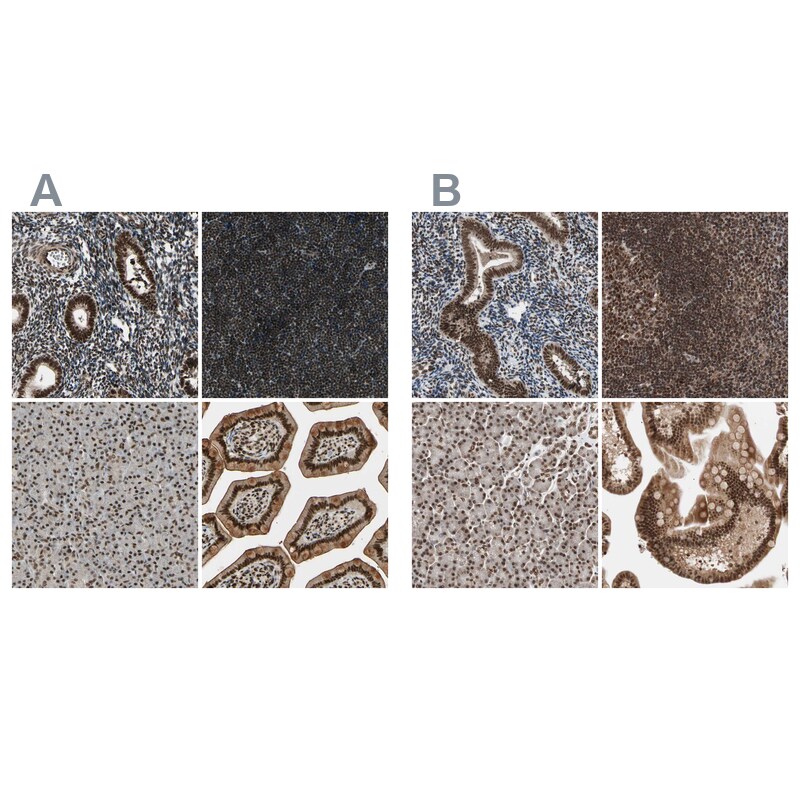 ZNF828 Antibody - BSA Free Immunohistochemistry-Paraffin: ZNF828 Antibody - BSA Free [NBP1-88403]
