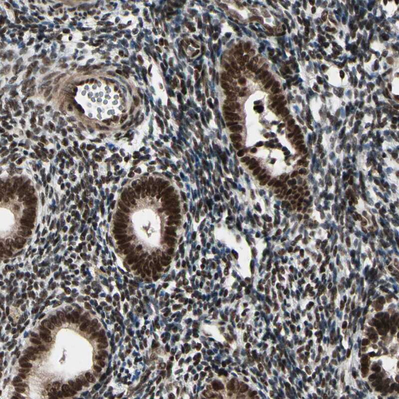 ZNF828 Antibody - BSA Free Immunohistochemistry-Paraffin: ZNF828 Antibody - BSA Free [NBP1-88403]