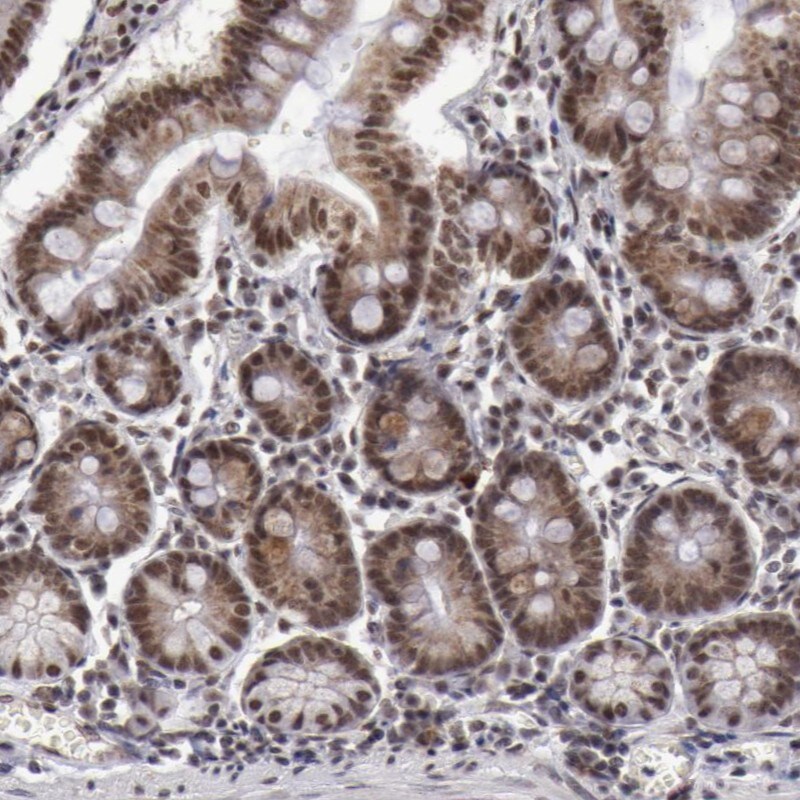 VRTN Antibody - BSA Free Immunohistochemistry-Paraffin: VRTN Antibody - BSA Free [NBP1-88406]
