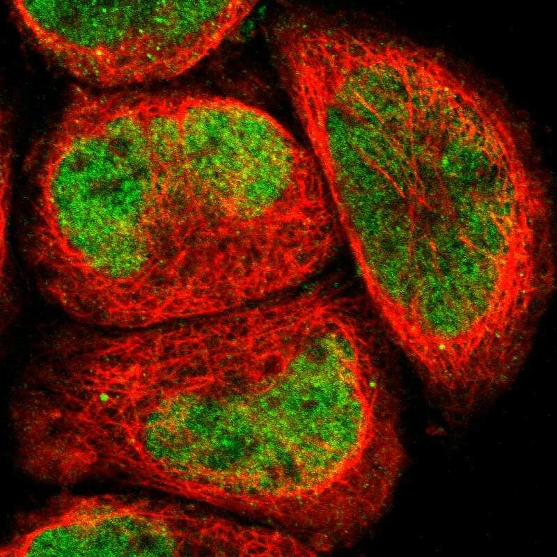 ELMSAN1 Antibody - BSA Free Immunocytochemistry/ Immunofluorescence: ELMSAN1 Antibody [NBP1-88407]