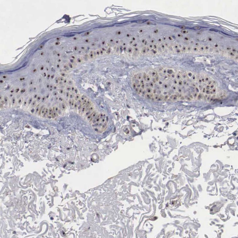 NGDN Antibody - BSA Free Immunohistochemistry-Paraffin: NGDN Antibody - BSA Free [NBP1-88408]