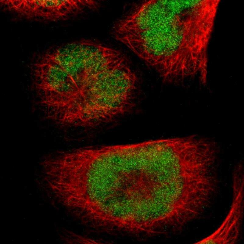 UBR7 Antibody - BSA Free Immunocytochemistry/ Immunofluorescence: UBR7 Antibody - BSA Free [NBP1-88409]