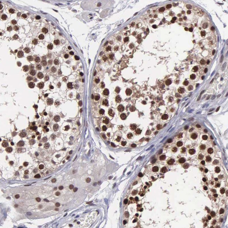 UBR7 Antibody - BSA Free Immunohistochemistry-Paraffin: UBR7 Antibody - BSA Free [NBP1-88409]