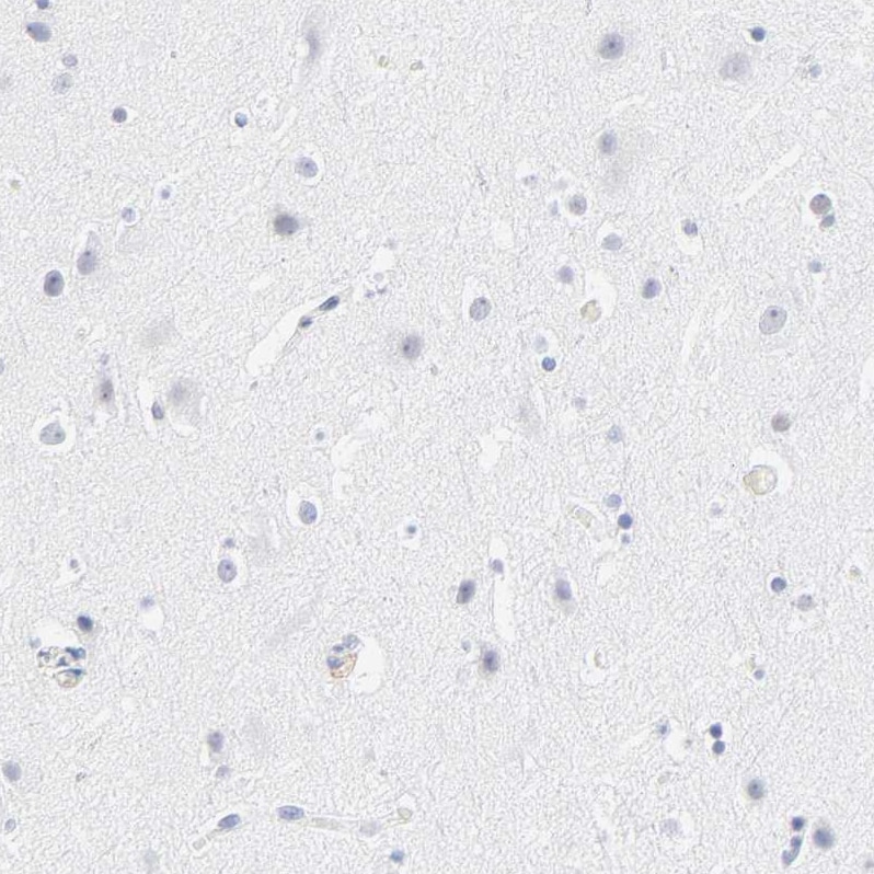 Latent TGF-beta bp2/LTBP-2 Antibody - BSA Free Immunohistochemistry-Paraffin: Latent TGF-beta bp2/LTBP-2 Antibody - BSA Free [NBP1-88411]