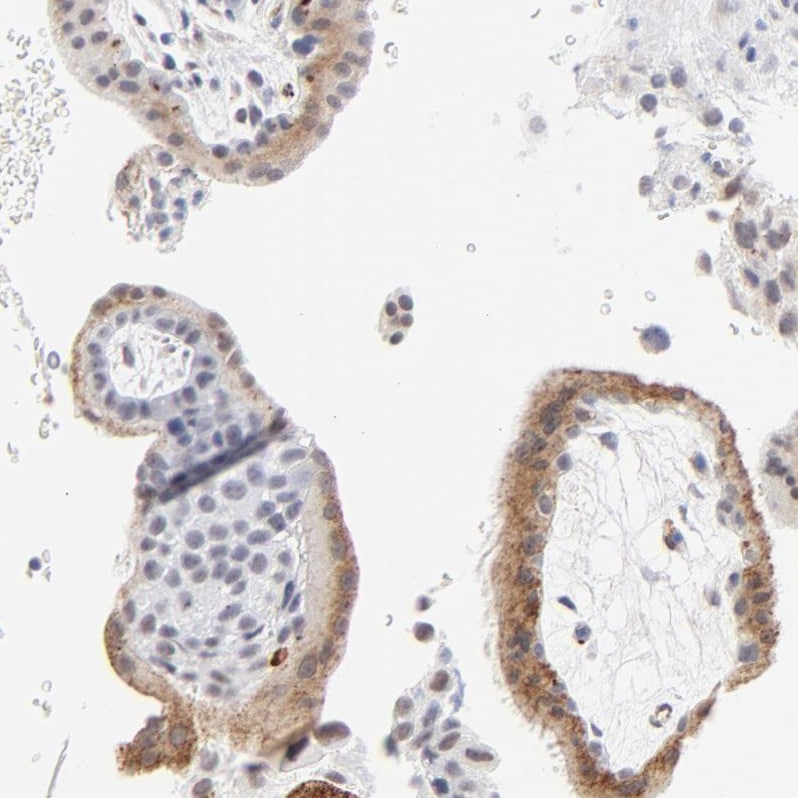 Latent TGF-beta bp2/LTBP-2 Antibody - BSA Free Immunohistochemistry-Paraffin: Latent TGF-beta bp2/LTBP-2 Antibody - BSA Free [NBP1-88411]