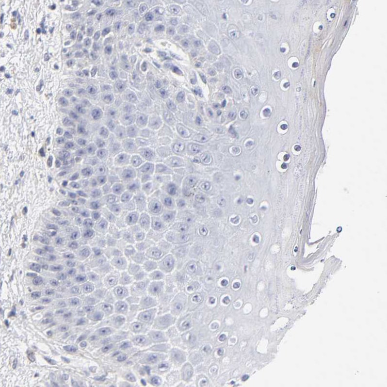 Latent TGF-beta bp2/LTBP-2 Antibody - BSA Free Immunohistochemistry-Paraffin: Latent TGF-beta bp2/LTBP-2 Antibody - BSA Free [NBP1-88411]