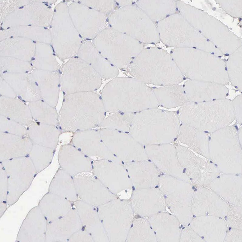 INF2 Antibody - BSA Free Immunohistochemistry-Paraffin: INF2 Antibody - BSA Free [NBP1-88414]