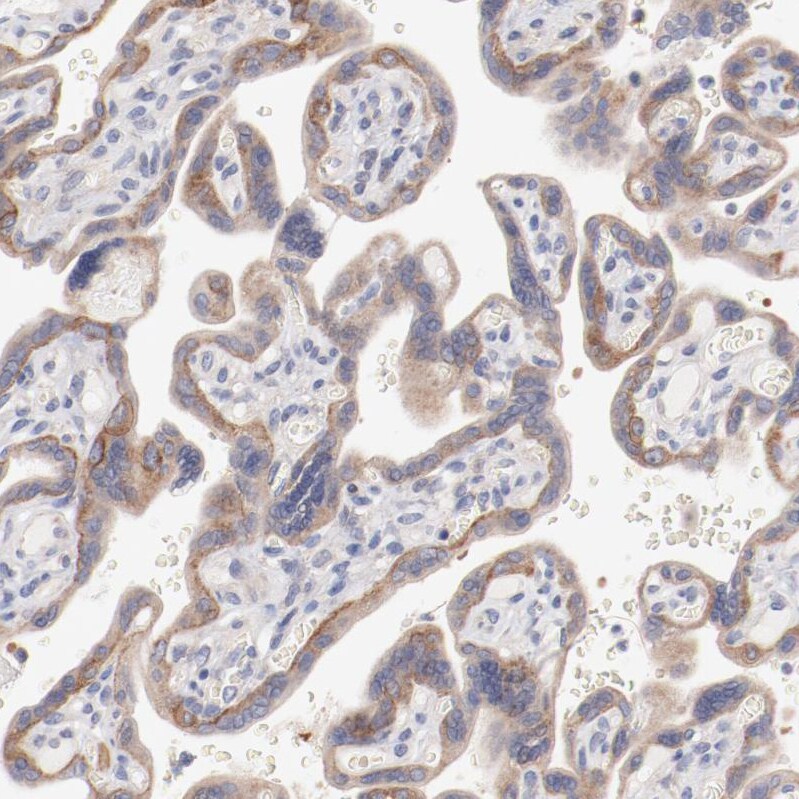 SETD3 Antibody - BSA Free Immunohistochemistry-Paraffin: SETD3 Antibody - BSA Free [NBP1-88415]