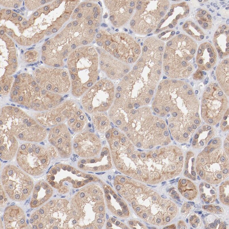 SETD3 Antibody - BSA Free Immunohistochemistry-Paraffin: SETD3 Antibody - BSA Free [NBP1-88415]