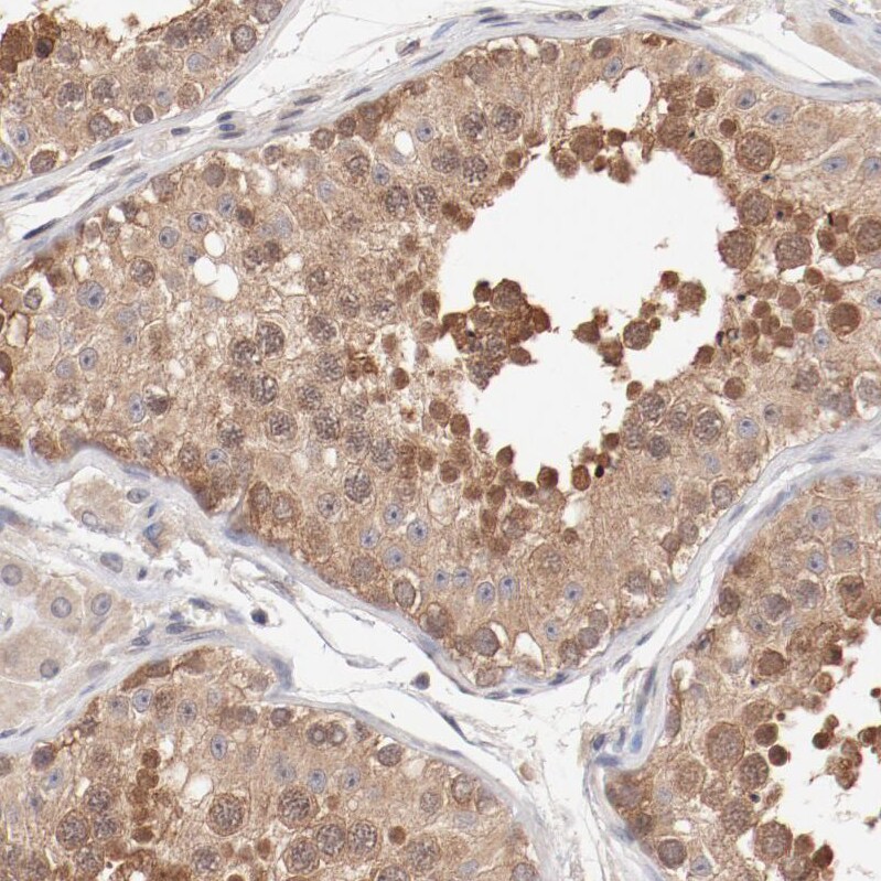 SETD3 Antibody - BSA Free Immunohistochemistry-Paraffin: SETD3 Antibody - BSA Free [NBP1-88415]