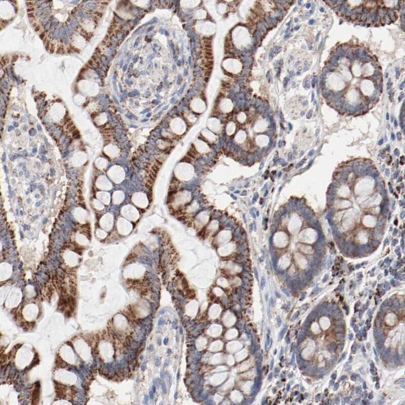 SETD3 Antibody - BSA Free Immunohistochemistry-Paraffin: SETD3 Antibody - BSA Free [NBP1-88416]